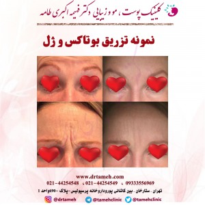 دکترپوست - دکترپوست و مو - دکتر زیبایی - بهترین دکتر پوست - بهترین دکتر پوست در ایران